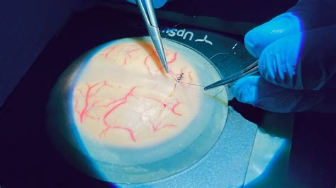 Image result for Simple Interrupted Suture Technique