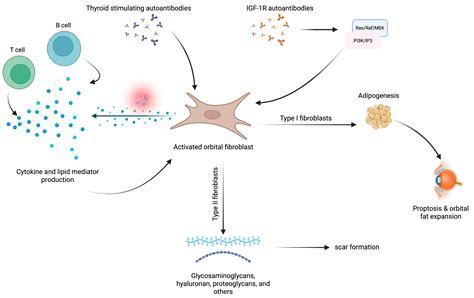 A Comprehensive Review of Thyroid Eye Disease Pathogenesis: From Immune ...