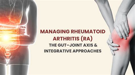 Rheumatoid Arthritis Week: Integrative Approaches to Managing RA ...