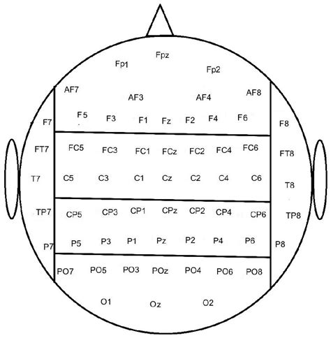 Single-Trial Classification of Error-Related Potentials in People with ...