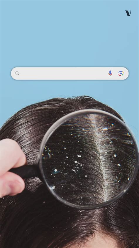 6 Common Hair Problems 1) Dandruff. Dandruff, scaly particles that cling to the root of the hair ...