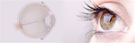 Effective Treatment of Glaucoma | Best Treatment Methods | Medtalks India