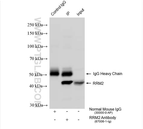 RRM2 antibody (67006-1-Ig) | Proteintech