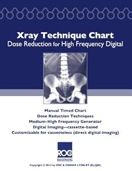 Xray Technique Chart Dose Reduction for High Frequency Digital eBook ...