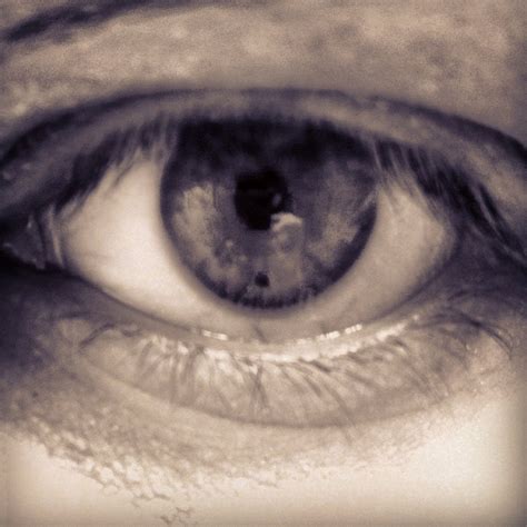 My eye has a little black dot on the iris. : mildlyinteresting