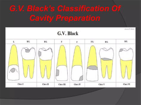 Classification of cavity cutting | PPTX