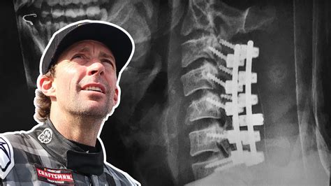 Travis Pastrana X Ray