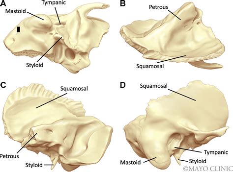 Temporal Bone Anatomy - Neuroimaging Clinics