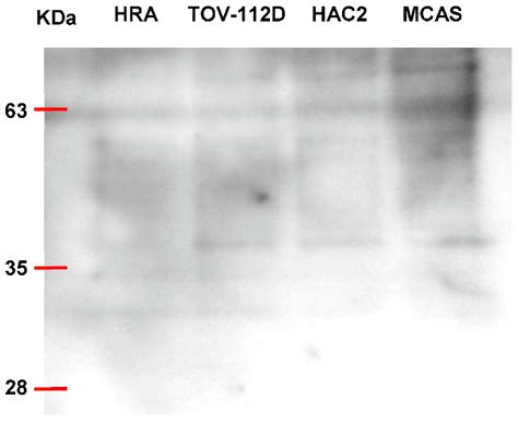 Exosomal MicroRNA as Biomarkers for Diagnosing or Monitoring the ...