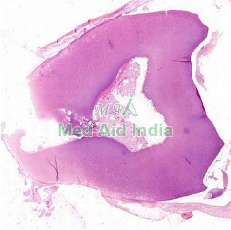 Digital Oral Pathology Slides Set Manufacturer, Supplier from Noida