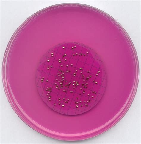 m-ENDO agar LES | 111277