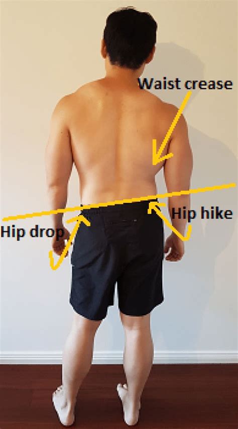 Lower Back Pain Tilted To One Side