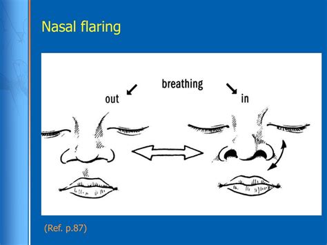 PPT - Recognizing Signs of Serious Neonatal Illness PowerPoint ...