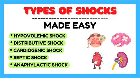 Image result for Different Types of Shock