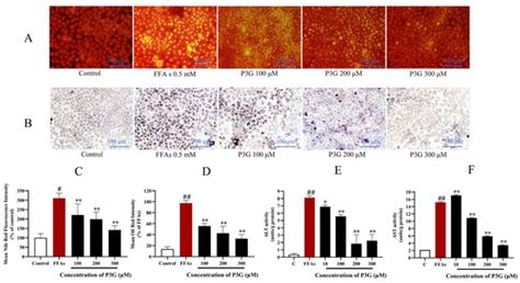 Peonidin-3-O-Glucoside from Purple Corncob Ameliorates Nonalcoholic ...