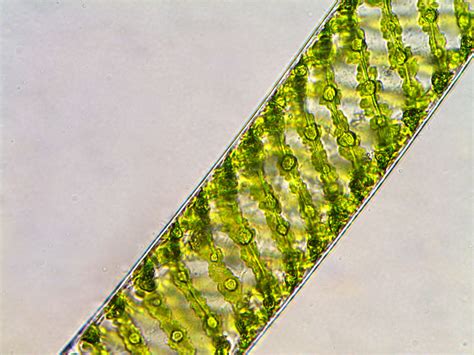 Spirogyra Algae Under Microscope