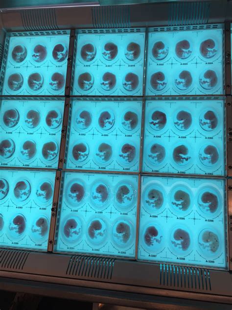 Alien Covenant Concept Art - Alien vs. Predator Galaxy