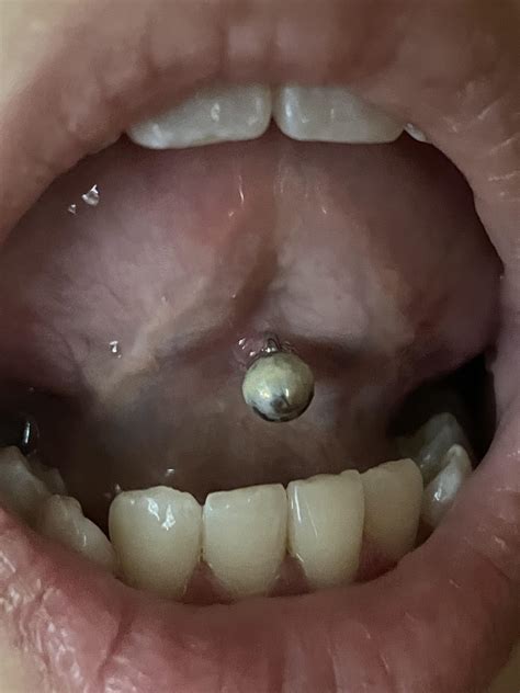 Bump on bottom of tongue piercing : r/piercing