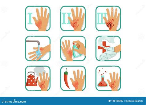 Primer Grado Quemaduras at Harry Northcott blog