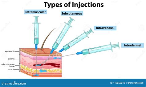 Intradermal vs Subcutaneous Injection 的图像结果