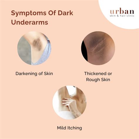 Dark Underarms Causes, Type, Symptoms & Treatment | USHC