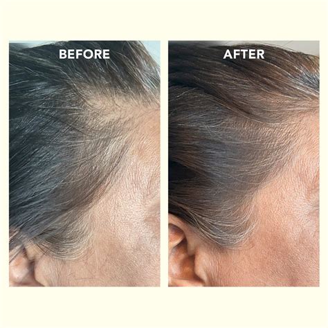 SHIKAKAI + BHRINGRAJ Stimulating Scalp Serum for Hair Growth – THE ...