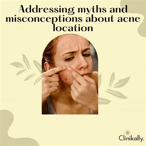 Period Acne: Symptoms, Causes and Treatment | Clinikally