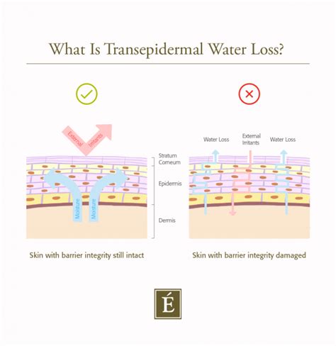 https://eminenceorganics.com/on/demandware.static/-/Library-Sites-EminenceSharedLibrary/default/dw668e460c/images/blog/Blog%20Infographics/v4_transepidermal_water_loss_1-600x618.png