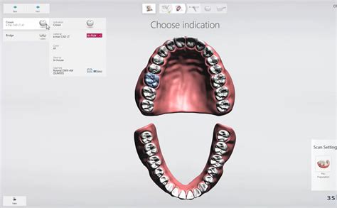 3Shape Design Studio 的图像结果