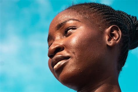 Image result for Sebum Plug Extraction