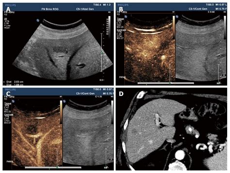 Image result for Ultrasound Lab