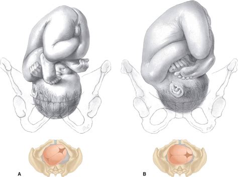 Normal Labor - Williams Obstetrics, 24th Edition