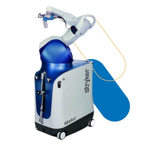 MAKOplasty Knee Replacement Precisely What the Doctor Ordered