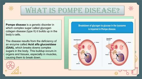 pompe-disease. its definition-study. pptx | PPTX