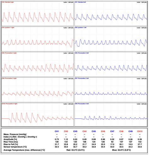 How to Use TOS Backtesting 的图像结果