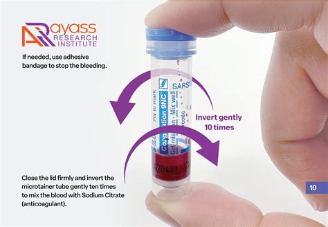 Transcriptome Procedure 的图像结果