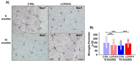 Effects of Dietary n-3 LCPUFA Supplementation on the Hippocampus of ...