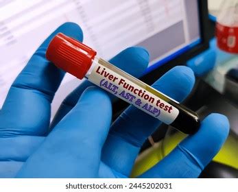 Image result for Liver Organ Function