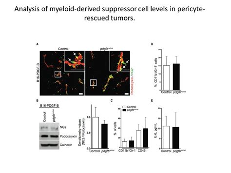 Role of Tumor Pericytes in the Recruitment of Myeloid-Derived ...