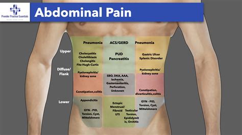 Pain Under Right Rib Extending To Back at Marcia Goforth blog