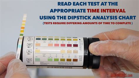 Urinalysis - OSCE Guide | Geeky Medics