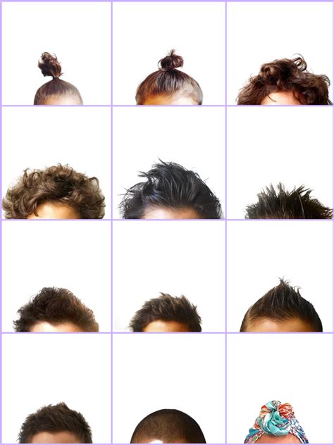 Chemotherapy Hair Loss Timeline