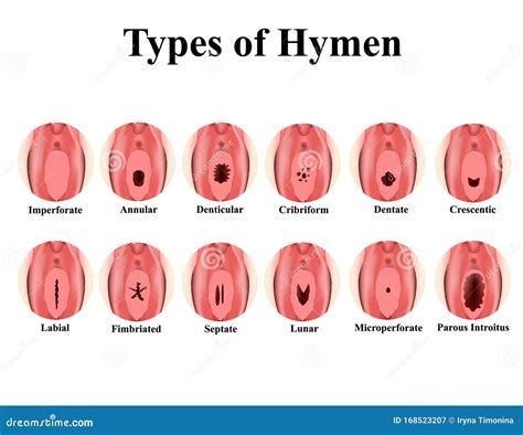 Can Your Hymen Grow Back