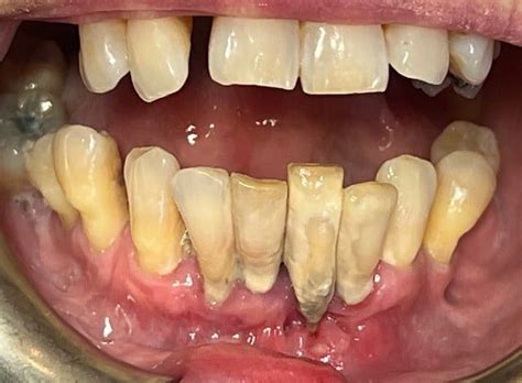 Toothache 的图像结果