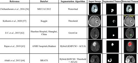 Image result for Brain Tumor Segmentation with Python Code