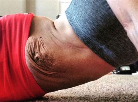 Athlete and mother praised for sharing photo of her stretch marks after ...
