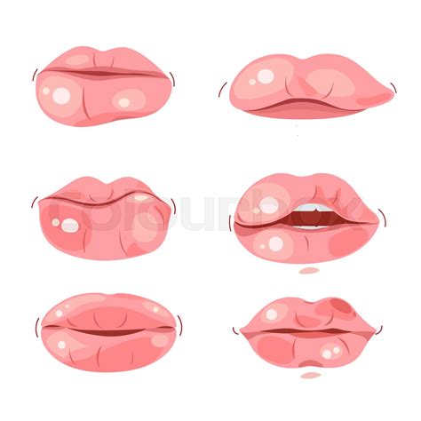 Swollen Lips Cartoon Images at Stella Prell blog