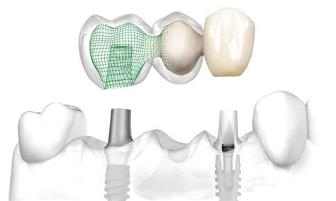 Dental Clinic in Ch. Sambhajinagar(Aurangabad) | Affordable Dental Care ...