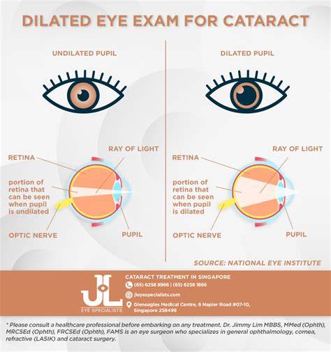 Eye Examination For Cataract