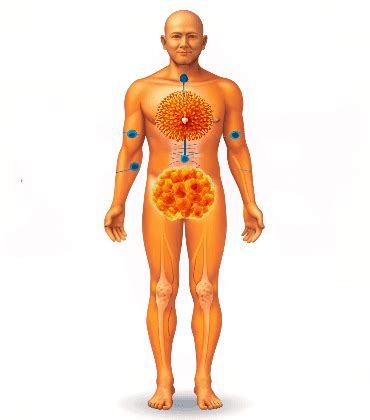 Expert Retroperitoneal Tumor Treatment in Gurugram | Dr. Vidur Garg